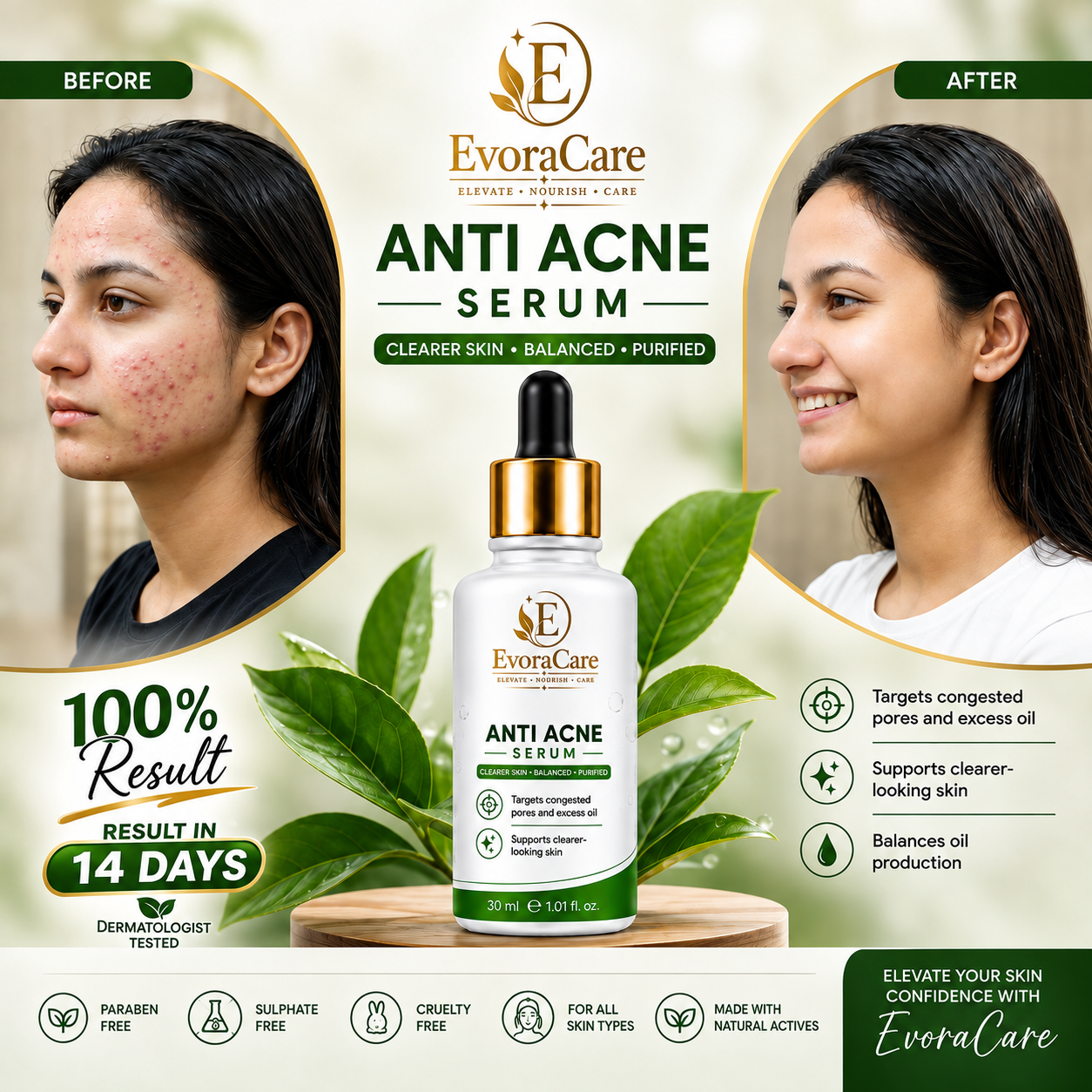Anti acne serum 30ML